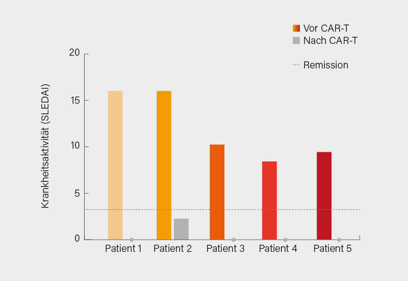 Abb. 2: Erste Erfahrungen zu CAR-T-Zelltherapie der Arbeitsgruppe aus Erlangen zu 5 Patienten: Markante Reduktion der Krankheitsaktivität (ohne Medikation) (11)